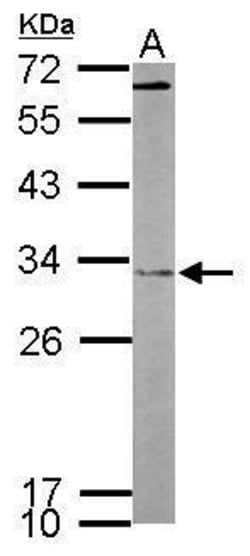 Invitrogen FHL2 Polyclonal Antibody 100 &mu;L; Unconjugated:Antibodies,