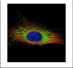 Invitrogen Gelsolin Polyclonal Antibody 100 &mu;L; Unconjugated:Anticuerpos