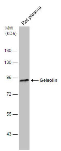 Invitrogen Gelsolin Polyclonal Antibody 100 &mu;L; Unconjugated:Anticuerpos