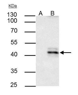 Invitrogen HLA-A Polyclonal Antibody 100 &mu;L; Unconjugated:Antibodies,