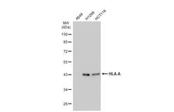 Invitrogen HLA-A Polyclonal Antibody 100 &mu;L; Unconjugated:Antibodies,