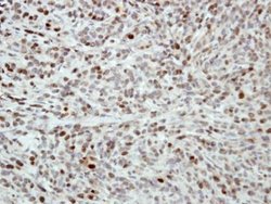 Invitrogen MCM5 Polyclonal Antibody 100 μL; Unconjugated:Antibodies,