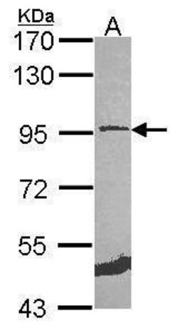 Invitrogen MCM5 Polyclonal Antibody 100 μL; Unconjugated:Antibodies,