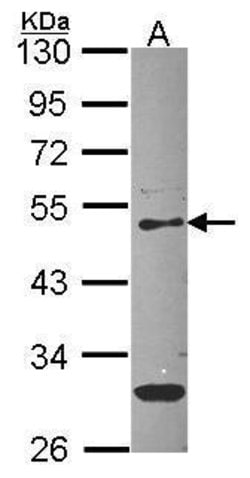Invitrogen PEDF Polyclonal Antibody 100 &mu;L | Buy Online | Invitrogen&trade; | Fisher Scientific