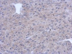 Invitrogen PNMT Polyclonal Antibody 100 &mu;L | Buy Online | Invitrogen&trade; | Fisher Scientific