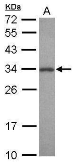 Invitrogen PNMT Polyclonal Antibody 100 &mu;L | Buy Online | Invitrogen&trade; | Fisher Scientific