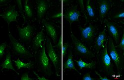 Invitrogen&trade;&nbsp;ROBO1 Polyclonal Antibody