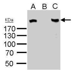 Invitrogen ROBO1 Polyclonal Antibody 100 &mu;L | Buy Online | Invitrogen&trade; | Fisher Scientific