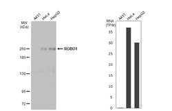 Invitrogen ROBO1 Polyclonal Antibody 100 &mu;L | Buy Online | Invitrogen&trade; | Fisher Scientific