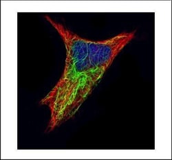 Invitrogen Cytokeratin 17 Polyclonal Antibody 100 &mu;L; Unconjugated:Antibodies,