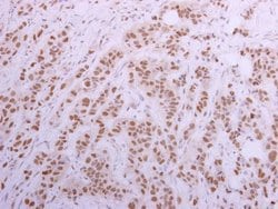 Invitrogen CUGBP1 Polyclonal Antibody 100 &mu;L; Unconjugated:Antibodies,