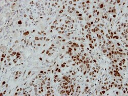 Invitrogen CUGBP1 Polyclonal Antibody 100 &mu;L; Unconjugated:Antibodies,