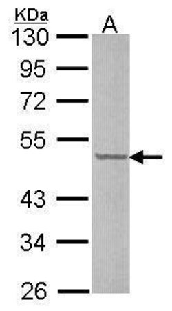 Invitrogen CUGBP1 Polyclonal Antibody 100 &mu;L; Unconjugated:Antibodies,