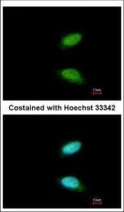 Invitrogen CREM Polyclonal Antibody 100 &mu;L; Unconjugated:Antibodies,