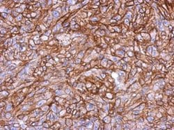 Invitrogen HLA-B Polyclonal Antibody 100 &mu;L; Unconjugated:Antibodies,