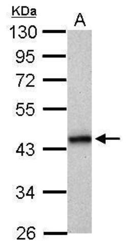 Invitrogen HLA-B Polyclonal Antibody 100 &mu;L; Unconjugated:Antibodies,