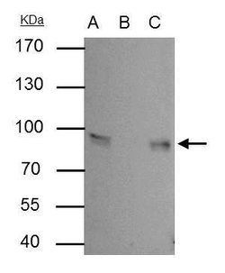 Invitrogen gamma Catenin Polyclonal Antibody 100 &mu;L; Unconjugated:Antibodies,