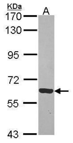 Invitrogen Rhotekin Polyclonal Antibody 100 &mu;L; Unconjugated:Antibodies,