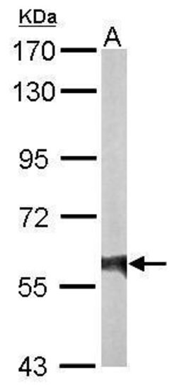 Invitrogen Rhotekin Polyclonal Antibody 100 &mu;L; Unconjugated:Antibodies,