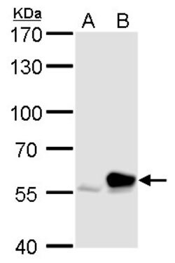 Invitrogen Rhotekin Polyclonal Antibody 100 &mu;L; Unconjugated:Antibodies,