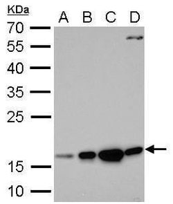 Invitrogen Destrin Polyclonal Antibody 100 &mu;L; Unconjugated:Antibodies,