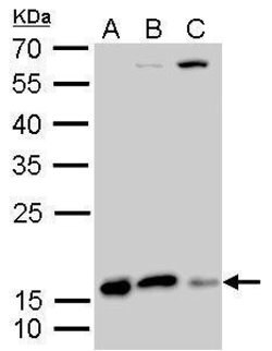 Invitrogen Destrin Polyclonal Antibody 100 &mu;L; Unconjugated:Antibodies,