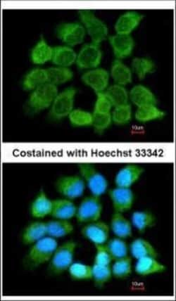 Invitrogen NNT1 Polyclonal Antibody 100 μL; Unconjugated:Antibodies,