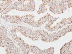 Invitrogen NNT1 Polyclonal Antibody 100 μL; Unconjugated:Antibodies,