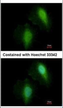 Invitrogen HDAC7 Polyclonal Antibody 100 &mu;L | Buy Online | Invitrogen&trade; | Fisher Scientific
