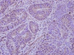 Invitrogen HDAC7 Polyclonal Antibody 100 &mu;L; Unconjugated:Antibodies,