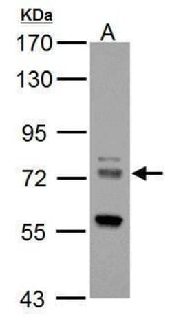 Invitrogen ZDHHC17 Polyclonal Antibody 100 &mu;L; Unconjugated:Antibodies,