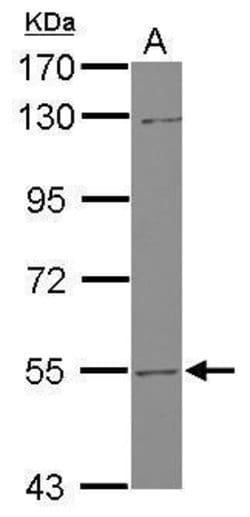Invitrogen UGT2B7 Polyclonal Antibody 100 &mu;L; Unconjugated:Antibodies,