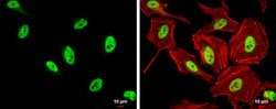 Invitrogen SFPQ Polyclonal Antibody 100 &mu;L; Unconjugated:Antibodies,