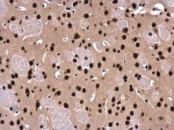 Invitrogen SFPQ Polyclonal Antibody 100 &mu;L; Unconjugated:Antibodies,
