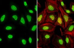 Invitrogen TDP-43 Polyclonal Antibody 100 &mu;L; Unconjugated:Antibodies,