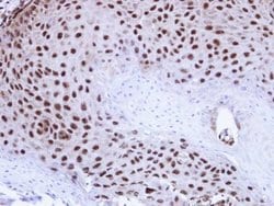 Invitrogen TDP-43 Polyclonal Antibody 100 &mu;L; Unconjugated:Antibodies,