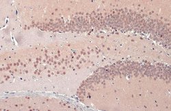 Invitrogen TDP-43 Polyclonal Antibody 100 &mu;L; Unconjugated:Antibodies,