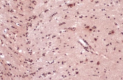 Invitrogen TDP-43 Polyclonal Antibody 100 &mu;L; Unconjugated:Antibodies,