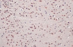 Invitrogen TDP-43 Polyclonal Antibody 100 &mu;L; Unconjugated:Antibodies,