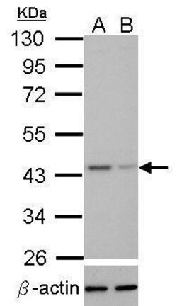Invitrogen TDP-43 Polyclonal Antibody 100 &mu;L; Unconjugated:Antibodies,
