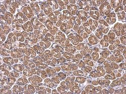 Invitrogen ACAA1 Polyclonal Antibody 100 &mu;L | Buy Online | Invitrogen&trade; | Fisher Scientific