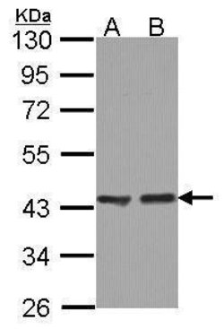 Invitrogen ACAA1 Polyclonal Antibody 100 &mu;L | Buy Online | Invitrogen&trade; | Fisher Scientific