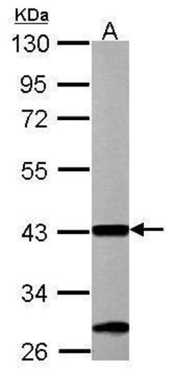 Invitrogen ACAA1 Polyclonal Antibody 100 &mu;L | Buy Online | Invitrogen&trade; | Fisher Scientific