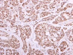 Invitrogen ACADVL Polyclonal Antibody 100 &mu;L | Buy Online | Invitrogen&trade; | Fisher Scientific