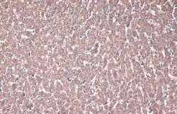 Invitrogen ACADVL Polyclonal Antibody 100 &mu;L | Buy Online | Invitrogen&trade; | Fisher Scientific