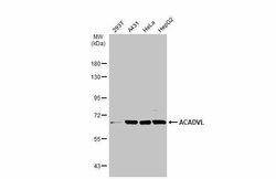 Invitrogen ACADVL Polyclonal Antibody 100 &mu;L | Buy Online | Invitrogen&trade; | Fisher Scientific