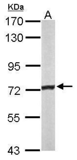 Invitrogen ACADVL Polyclonal Antibody 100 &mu;L | Buy Online | Invitrogen&trade; | Fisher Scientific
