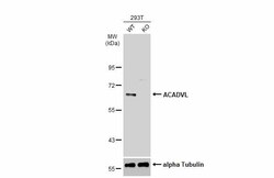 Invitrogen ACADVL Polyclonal Antibody 100 &mu;L | Buy Online | Invitrogen&trade; | Fisher Scientific