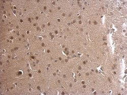 Invitrogen ADSL Polyclonal Antibody 100 &mu;L; Unconjugated:Antibodies,