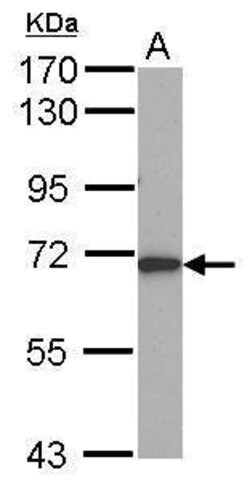 Invitrogen ALAS1 Polyclonal Antibody 100 &mu;L; Unconjugated:Antibodies,
